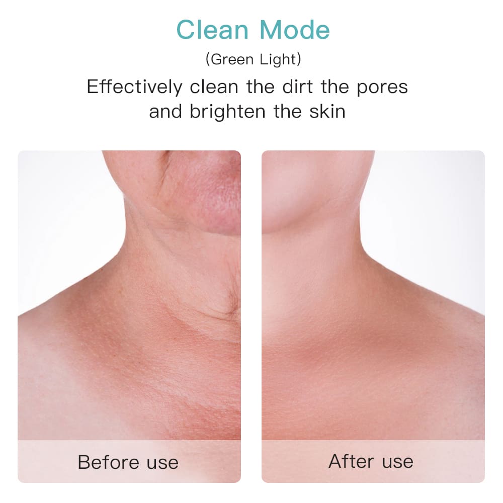 Detergent eficient pentru pori pe față sau pe gât înainte și după